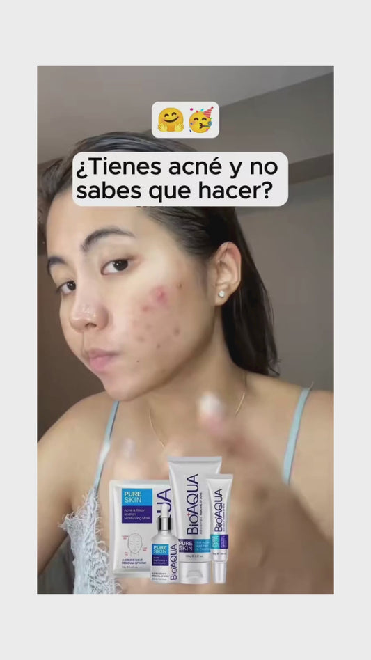 COMBO ANTIACNÉ BIOAQUA + Caja de Seguridad